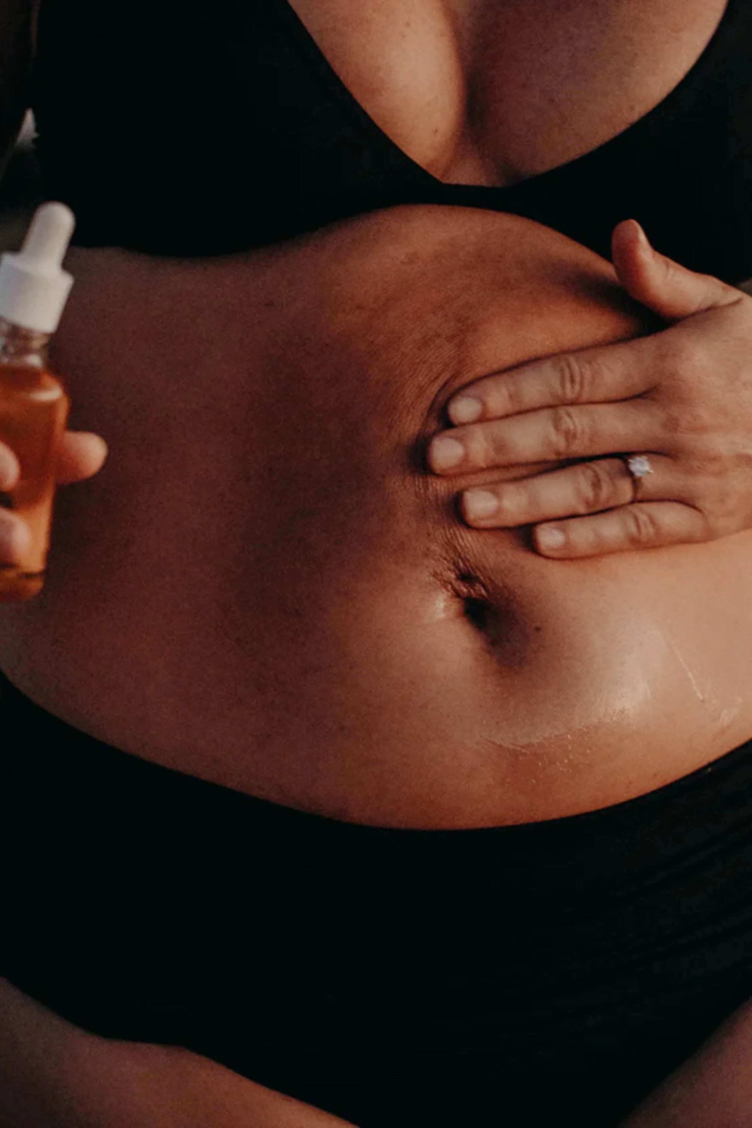 Skin & Scar Oil - Image 4